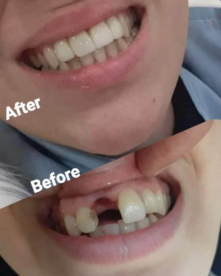 Teeth doctar in gwalior