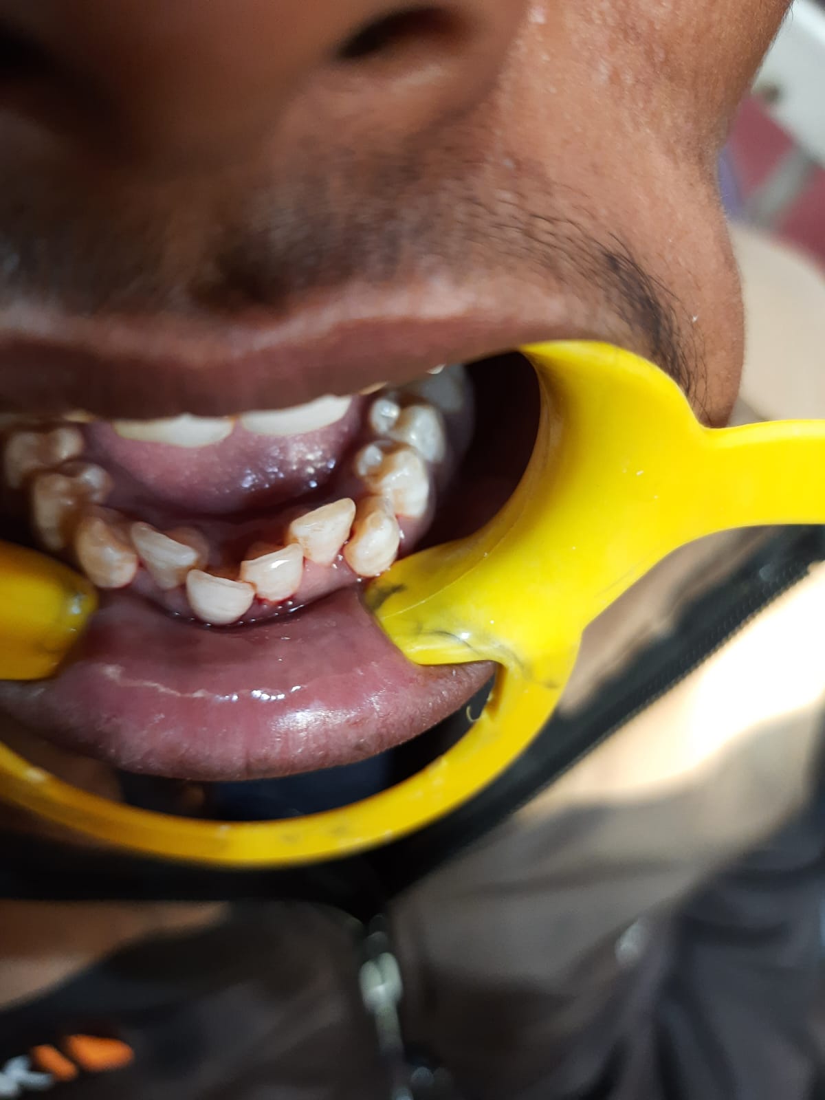Divy Dental Care Clinic in gwalior