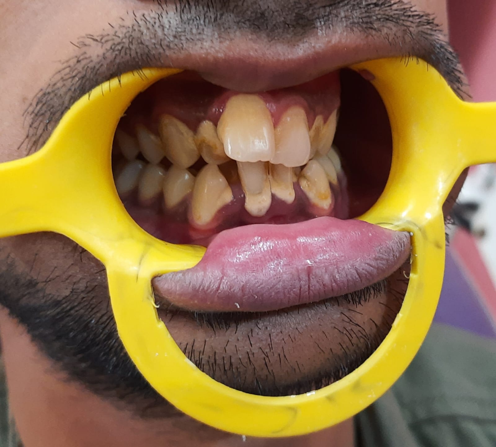 Dental clinic in gwalior