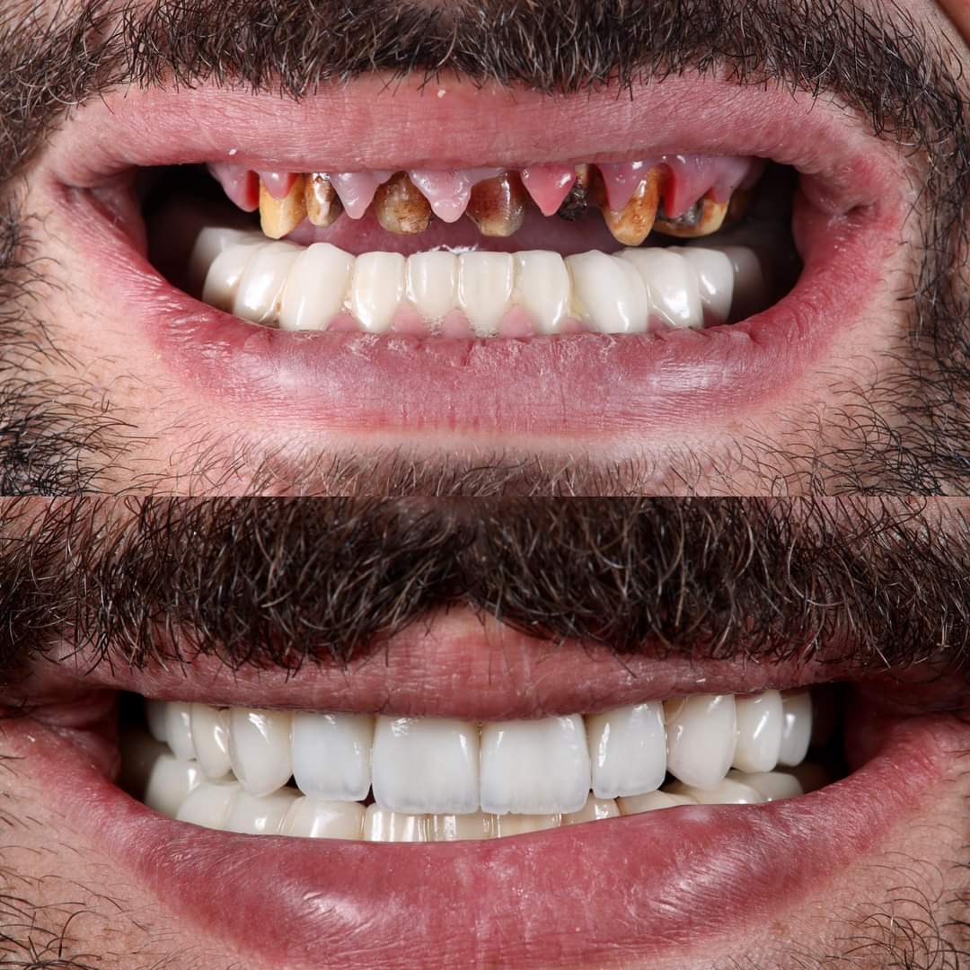 cosmetic dentistry specialist in gwalior
