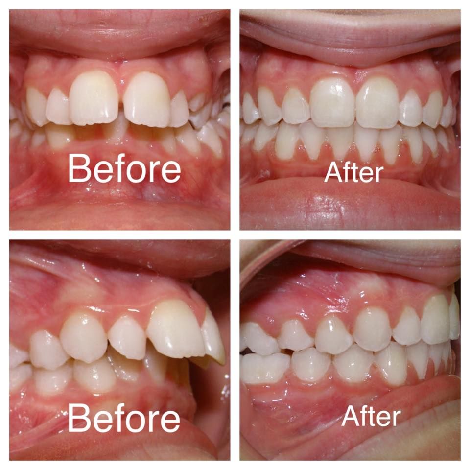 Dentist in gwalior