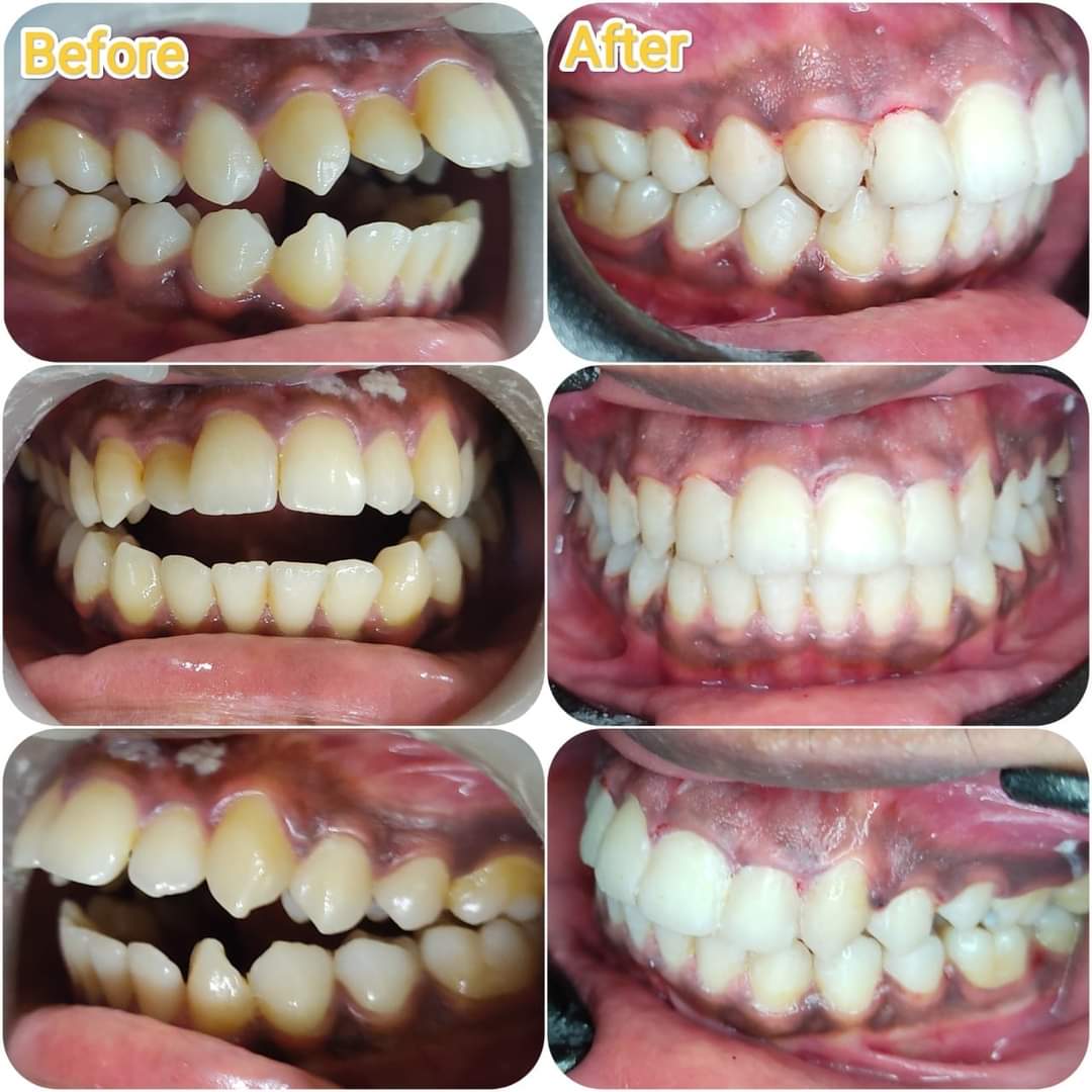 Best teeth doctar in gwalior