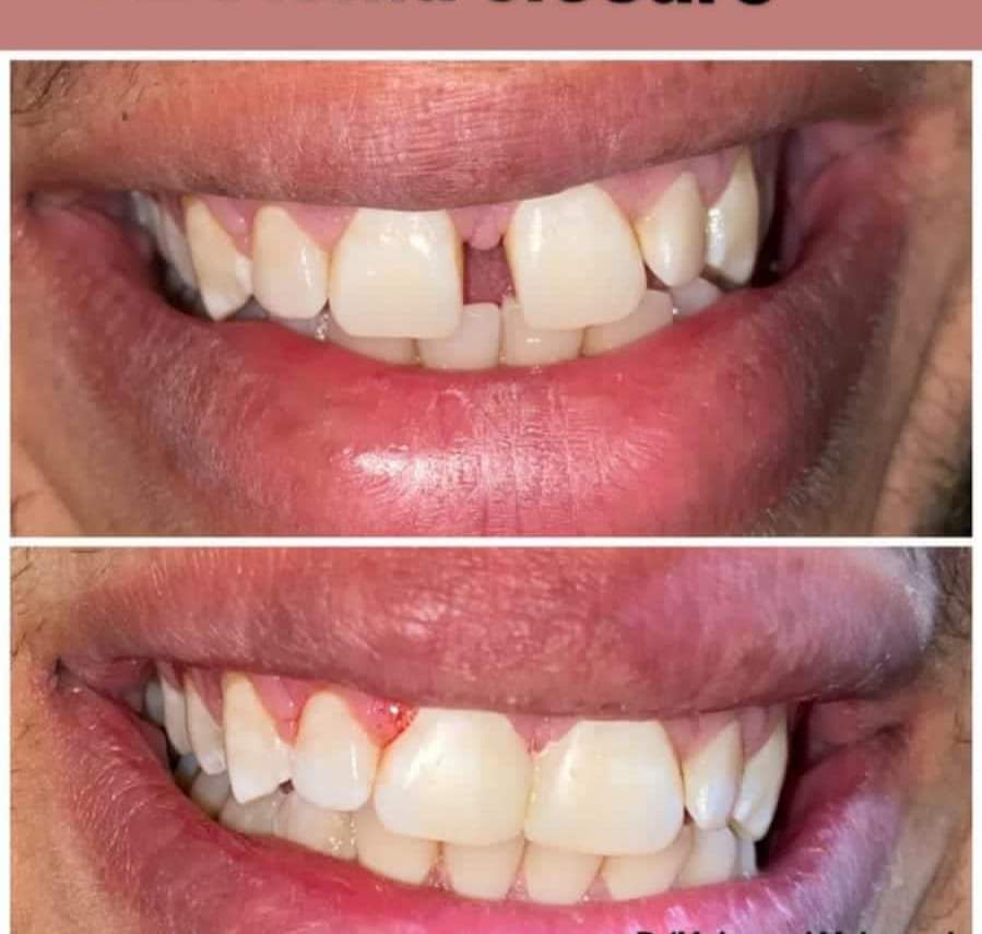 Best teeth doctar in gwalior