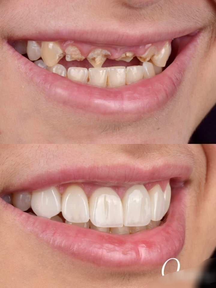 Dentist in gwalior