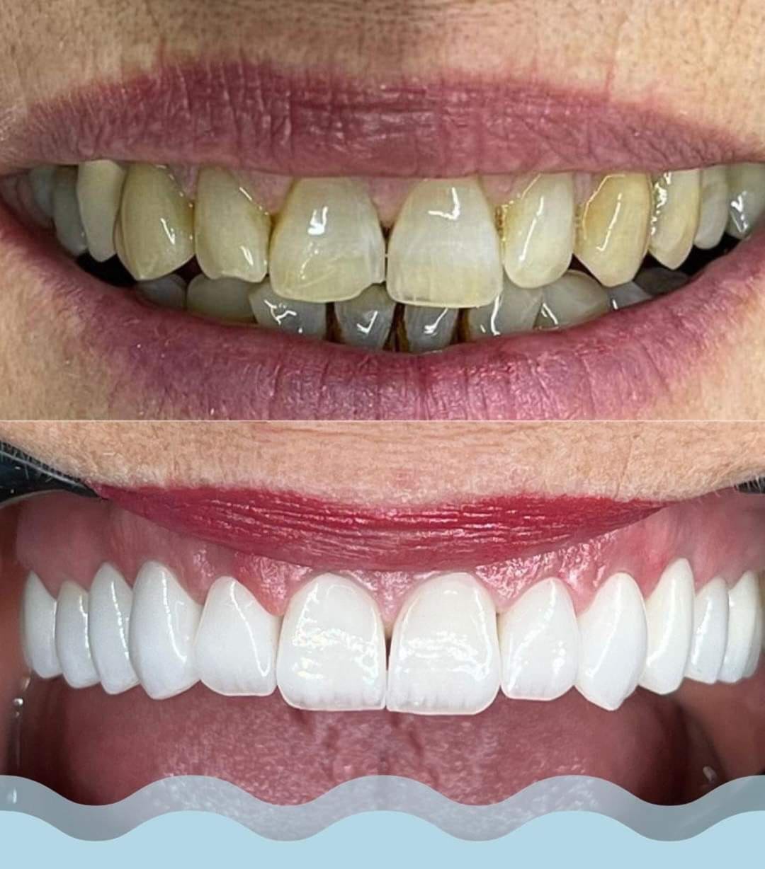 Best dental clinic in gwalior