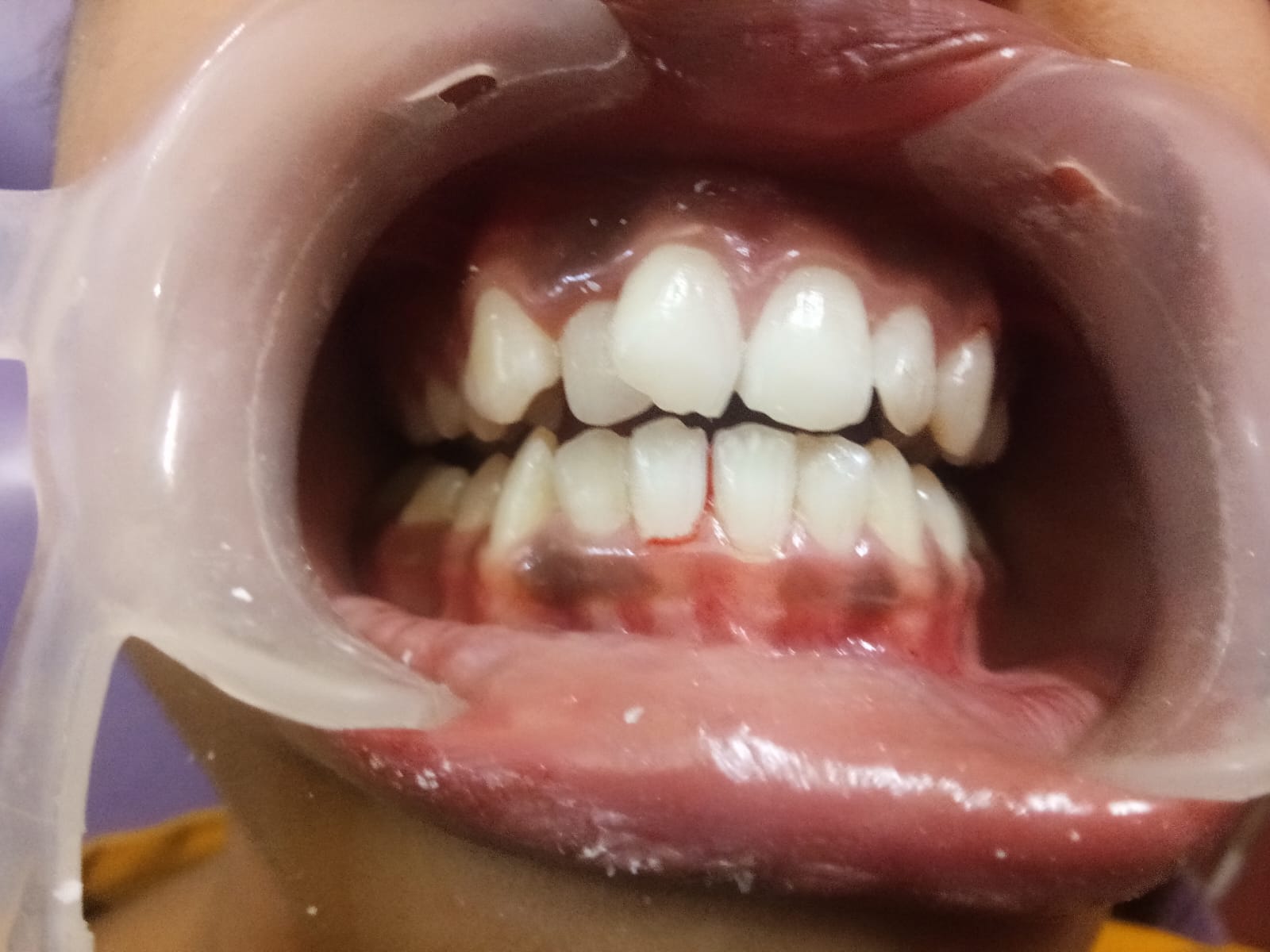 Teeth clinic in gwalior