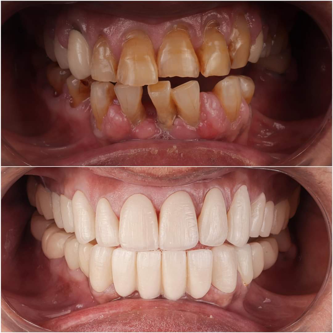 Best dental clinic in gwalior