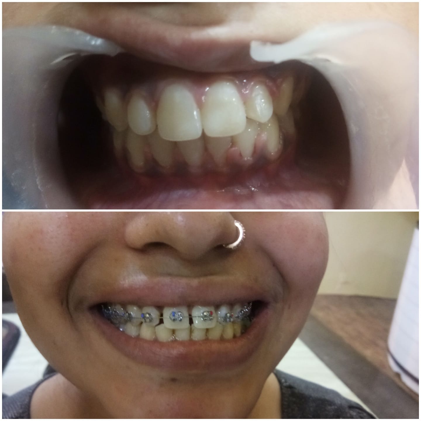 Dentist in gwalior