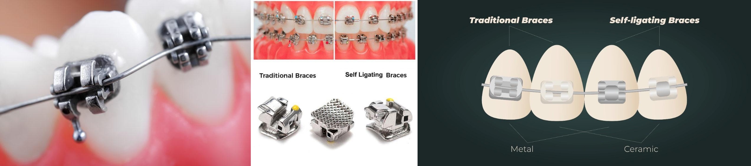 Teeth doctar in gwalior