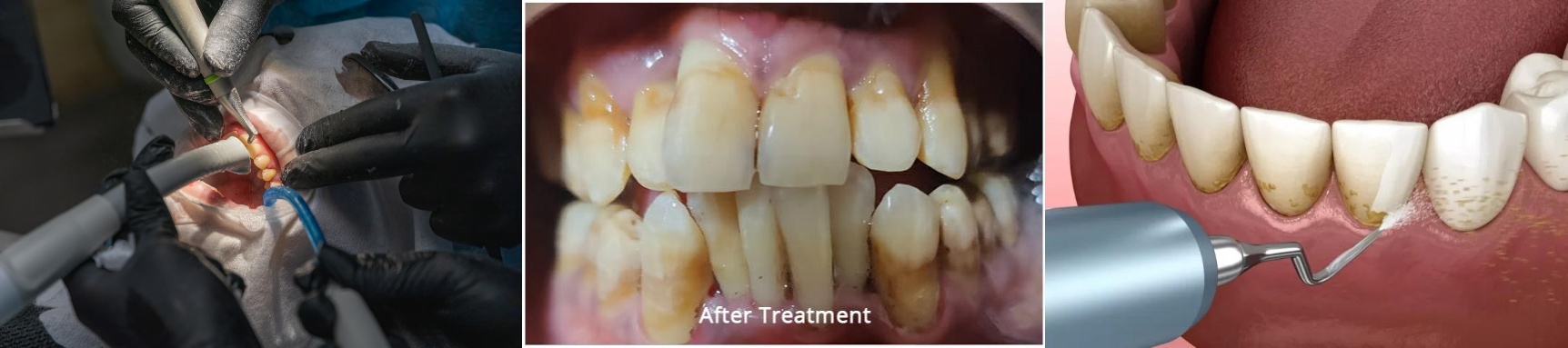 Teeth doctar in gwalior